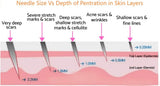 Derma Roller