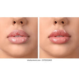 Vital Lip oil Clear 0.52oz - URBAN BEAUTE